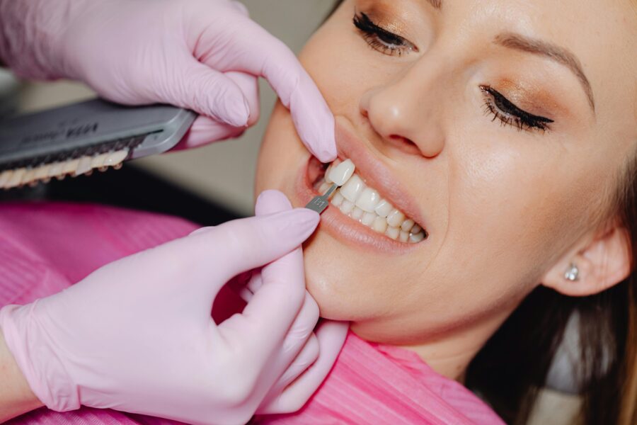 A patient gets cosmetic dentistry with a dental shade guide for tooth color matching.